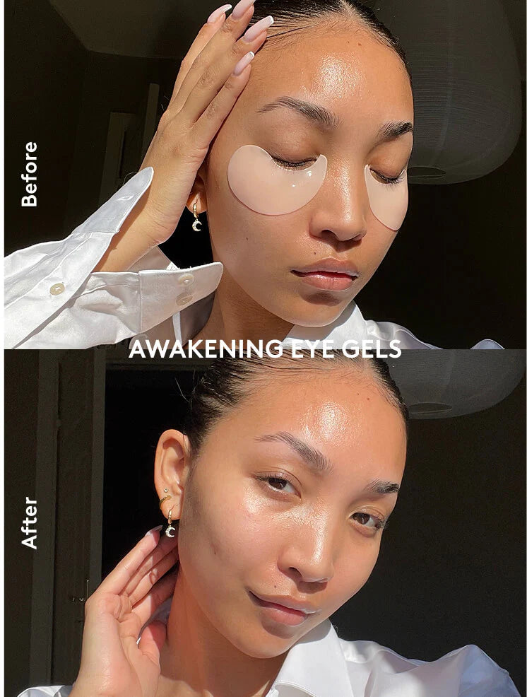 XLASH gel jastučići na očima modela za smanjenje natečenosti