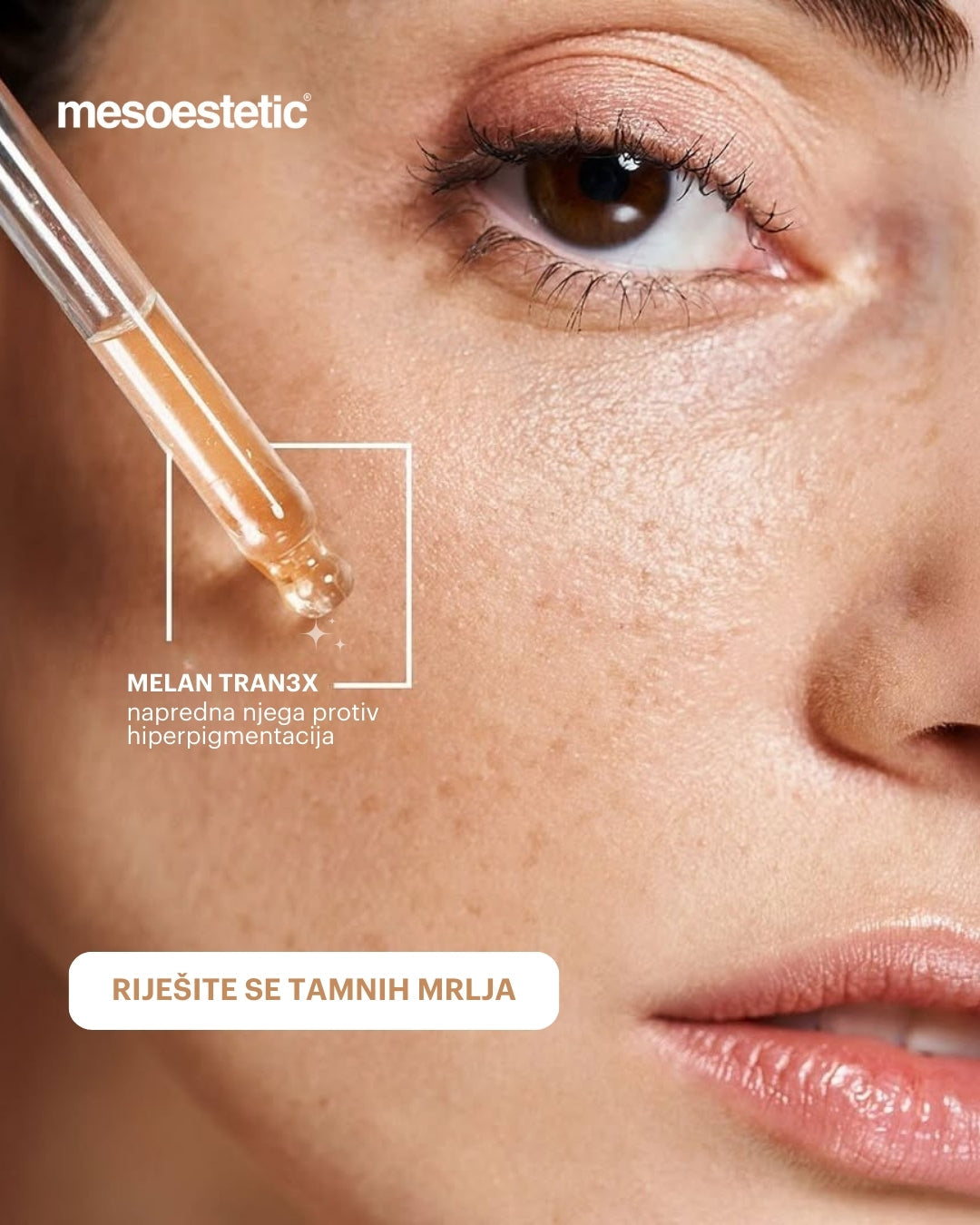 mesoesthetic melan tran3X concentrate