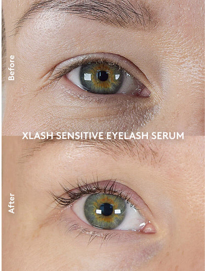Prikaz rezultata korištenja Xlash Sensitive seruma