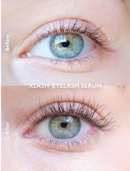 Model s naglašenim trepavicama nakon upotrebe XLASH seruma