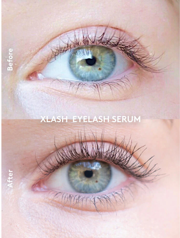 Model s naglašenim trepavicama nakon upotrebe XLASH seruma